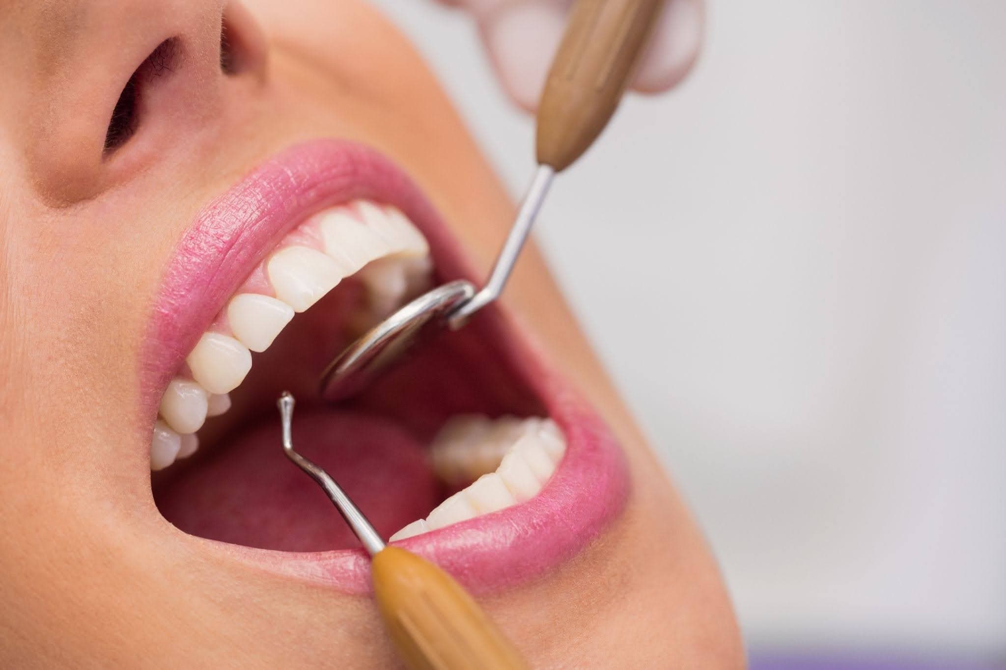 10 Everyday Dental Care Tips