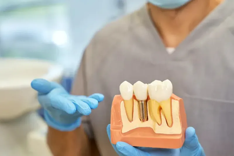 Root canal treatment performed by experienced dentist