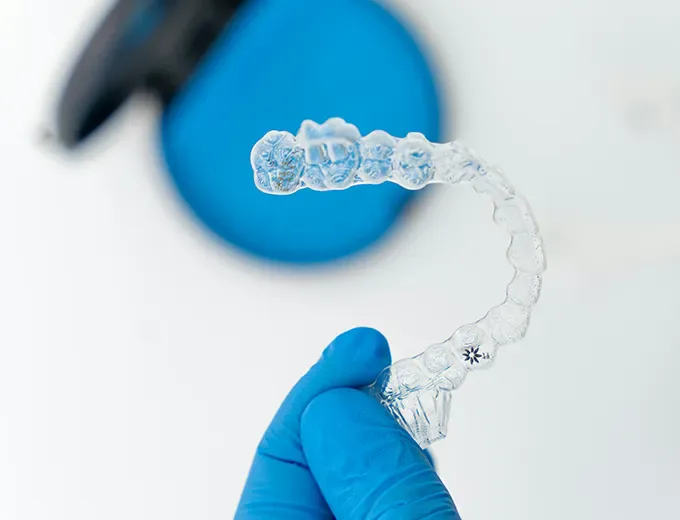 Invisalign aligners improving smile alignment and bite correction